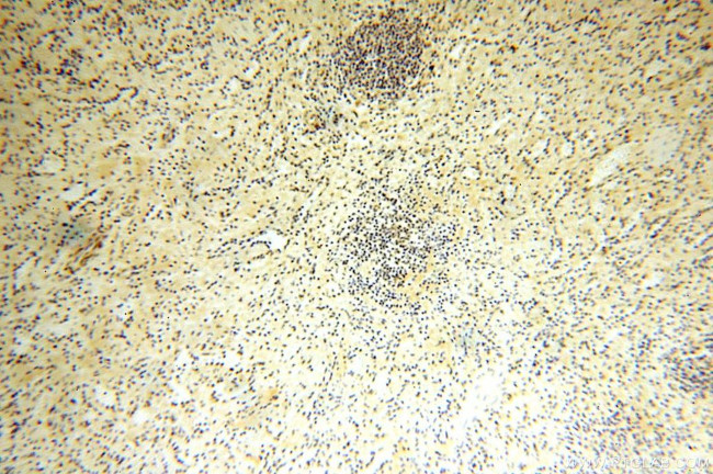 MGMT Antibody in Immunohistochemistry (Paraffin) (IHC (P))