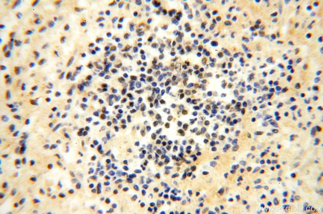 MGMT Antibody in Immunohistochemistry (Paraffin) (IHC (P))