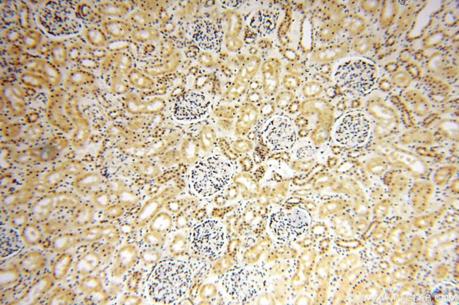 MGMT Antibody in Immunohistochemistry (Paraffin) (IHC (P))