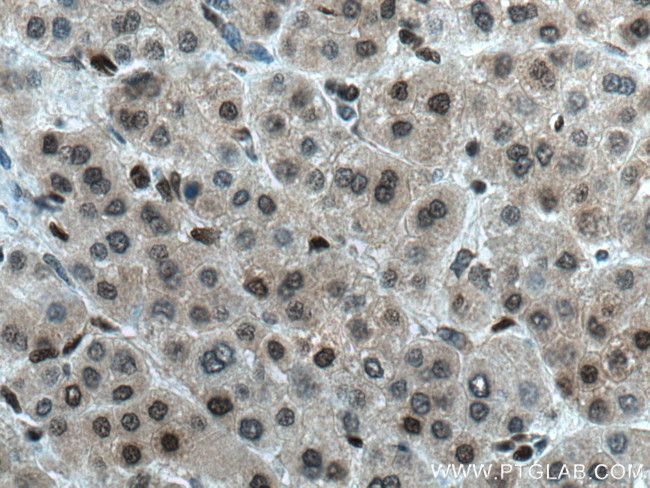 MGMT Antibody in Immunohistochemistry (Paraffin) (IHC (P))