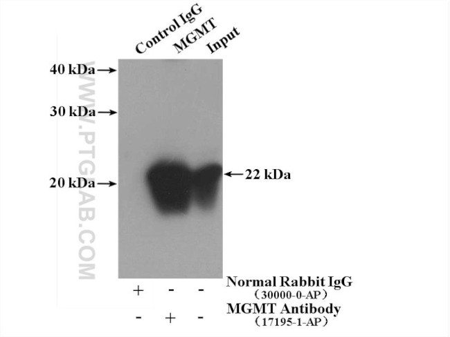 MGMT Antibody in Immunoprecipitation (IP)
