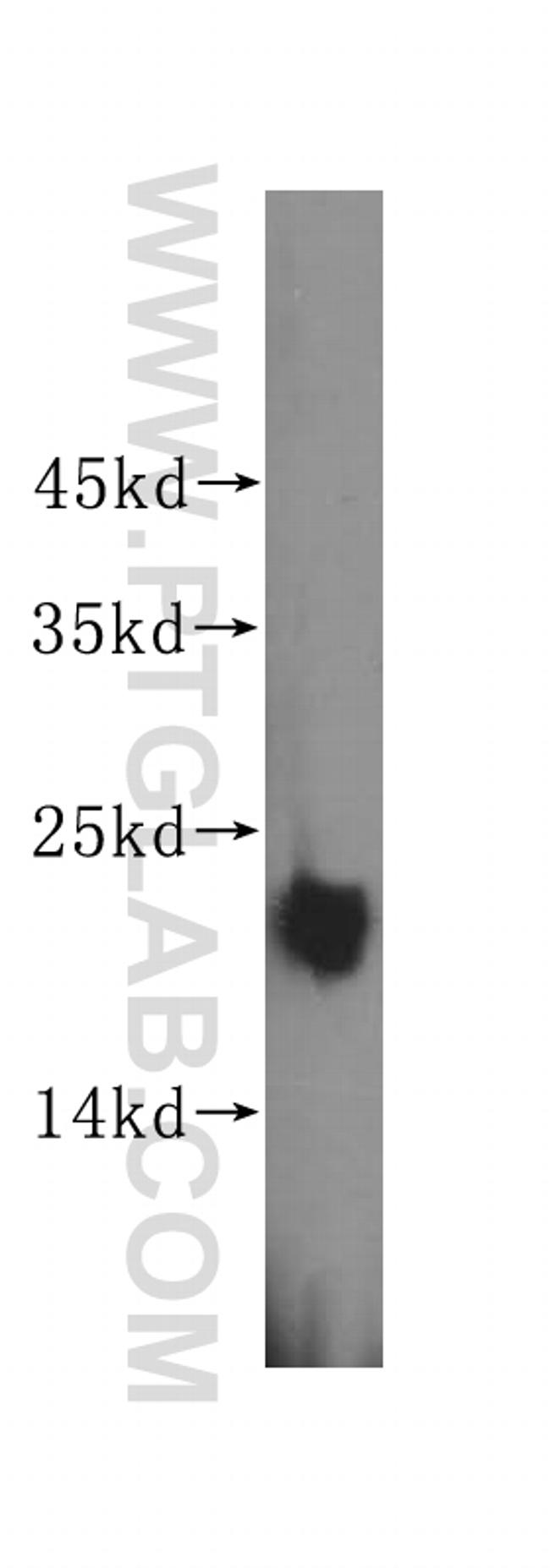 MGMT Antibody in Western Blot (WB)