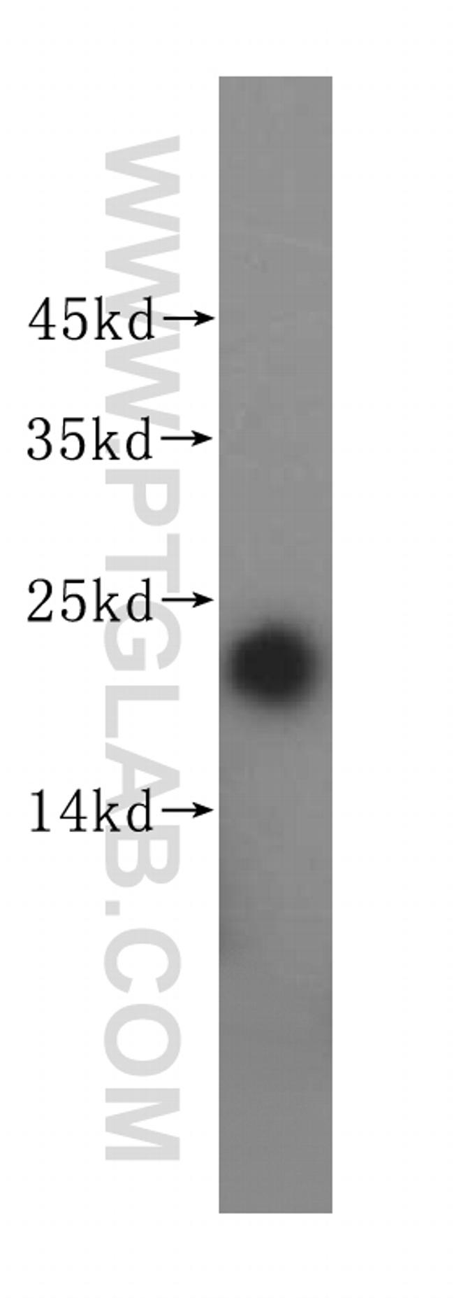 MGMT Antibody in Western Blot (WB)