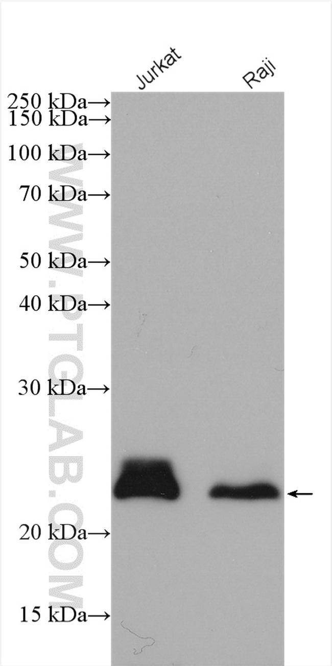 MGMT Antibody in Western Blot (WB)