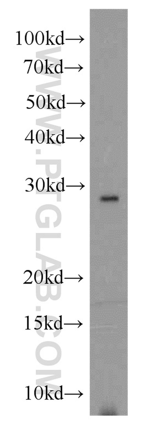 RNASE11 Antibody in Western Blot (WB)