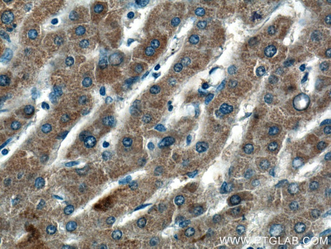 HMGCLL1 Antibody in Immunohistochemistry (Paraffin) (IHC (P))