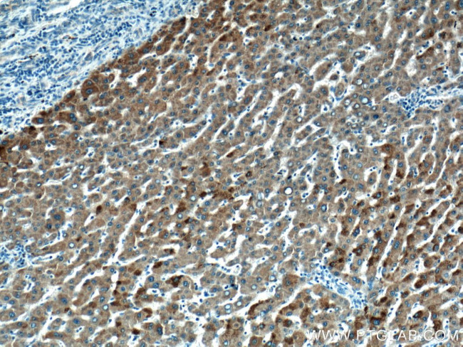 HMGCLL1 Antibody in Immunohistochemistry (Paraffin) (IHC (P))