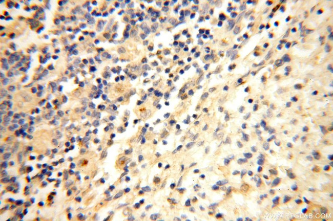 LYZL1 Antibody in Immunohistochemistry (Paraffin) (IHC (P))