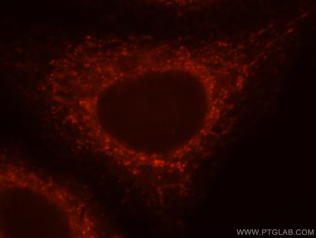 NLRX1 Antibody in Immunocytochemistry (ICC/IF)