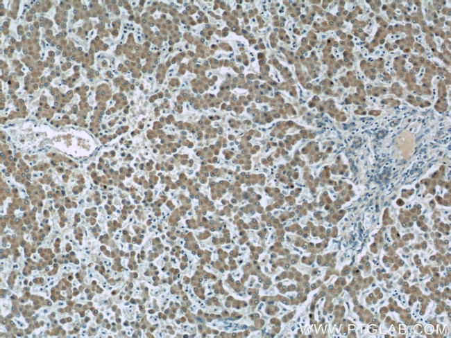 NLRX1 Antibody in Immunohistochemistry (Paraffin) (IHC (P))