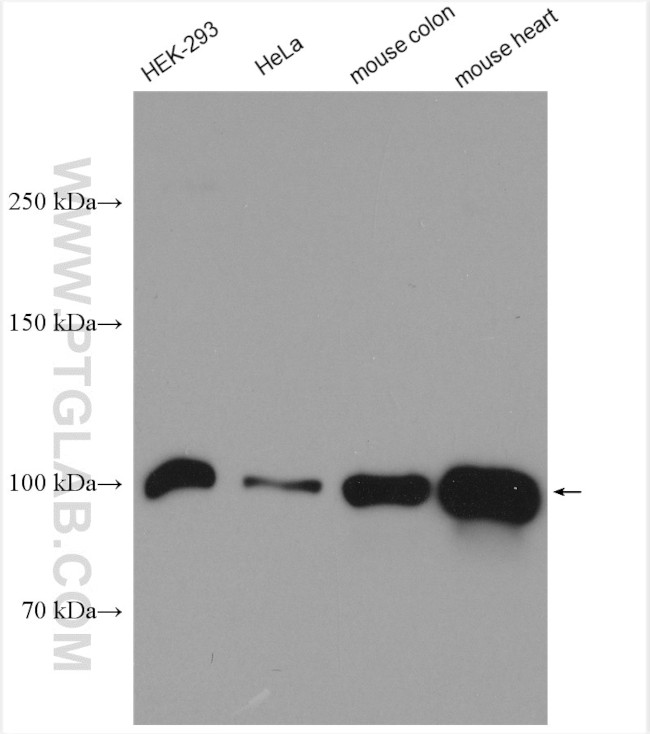 NLRX1 Antibody in Western Blot (WB)