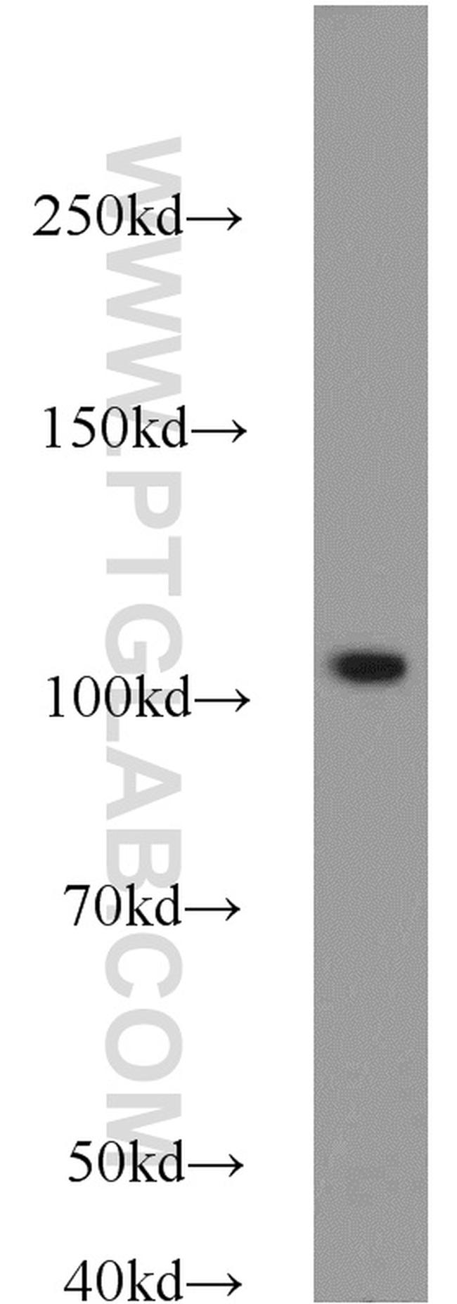 NLRX1 Antibody in Western Blot (WB)