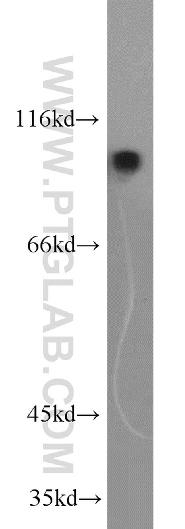 NLRX1 Antibody in Western Blot (WB)