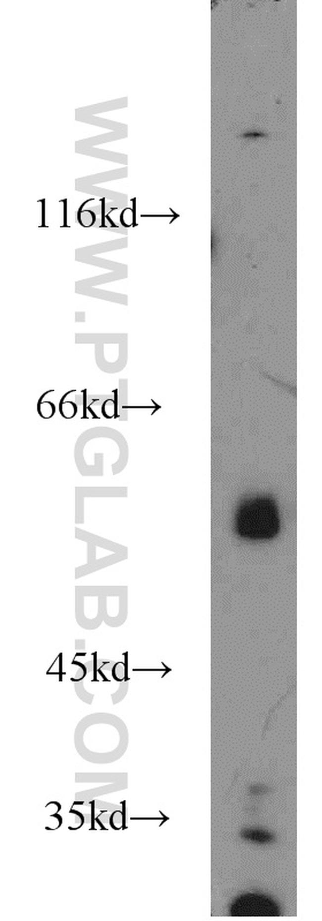 OSBPL2 Antibody in Western Blot (WB)