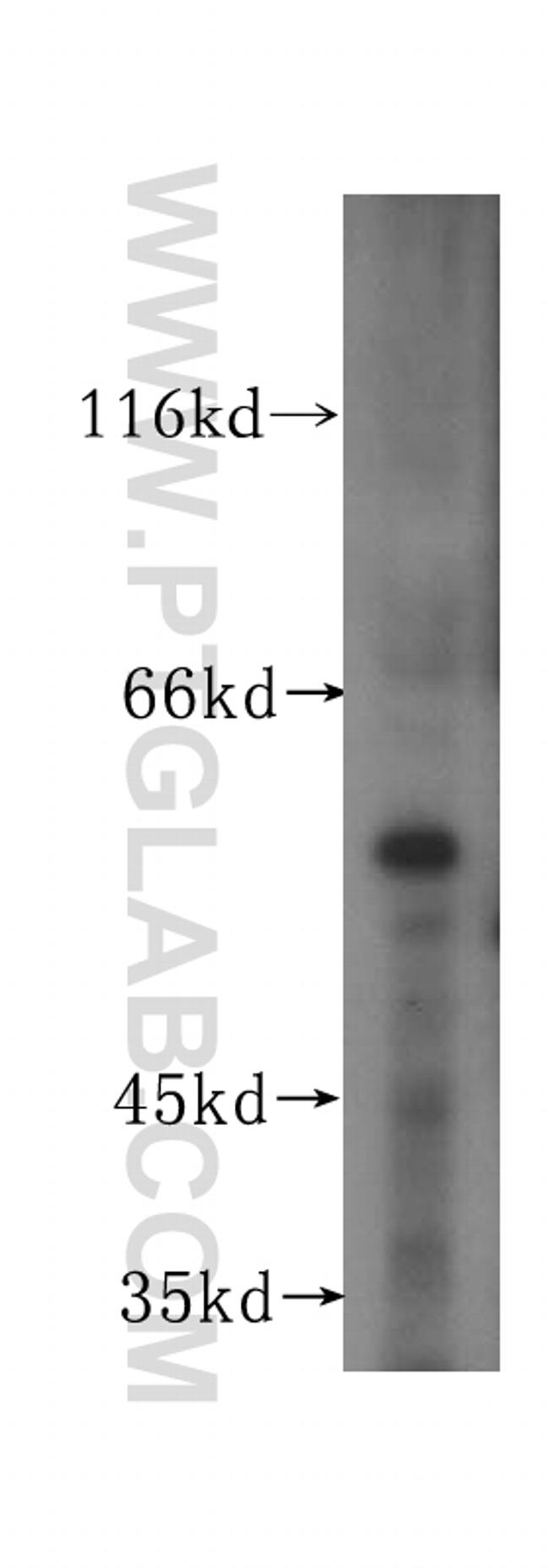 OSBPL2 Antibody in Western Blot (WB)