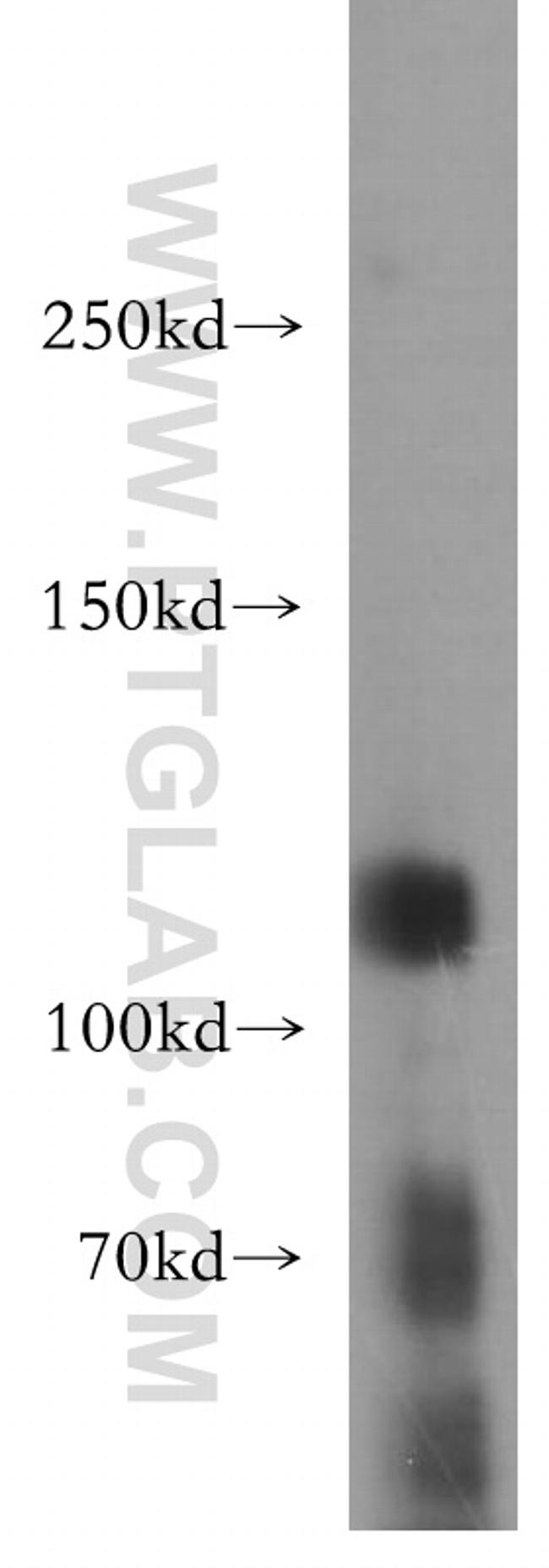 Rb Antibody in Western Blot (WB)