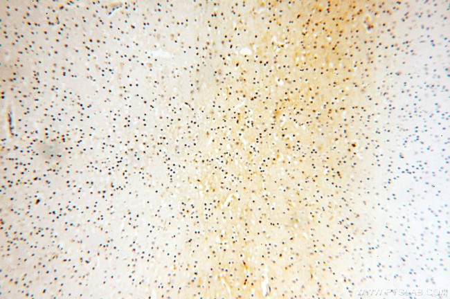 GPD2 Antibody in Immunohistochemistry (Paraffin) (IHC (P))