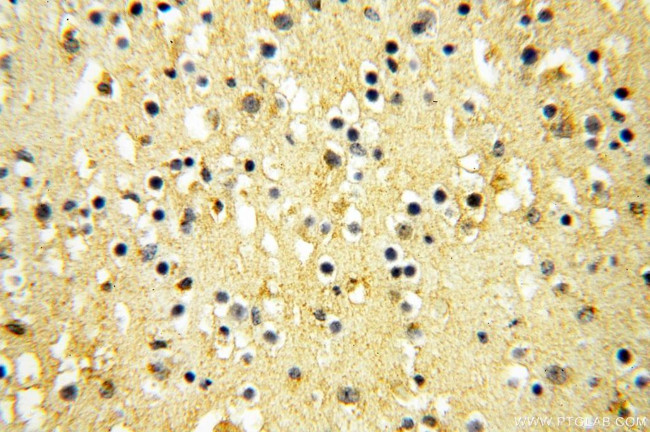 GPD2 Antibody in Immunohistochemistry (Paraffin) (IHC (P))