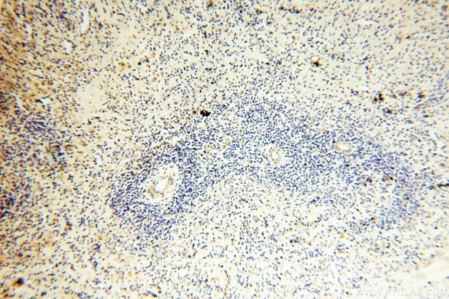 GPD2 Antibody in Immunohistochemistry (Paraffin) (IHC (P))