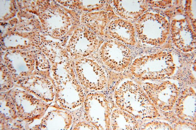 GPD2 Antibody in Immunohistochemistry (Paraffin) (IHC (P))