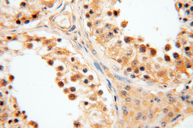 GPD2 Antibody in Immunohistochemistry (Paraffin) (IHC (P))