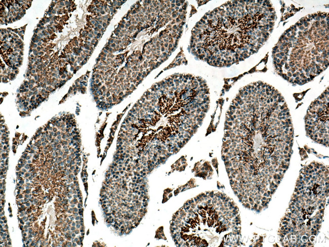 GPD2 Antibody in Immunohistochemistry (Paraffin) (IHC (P))