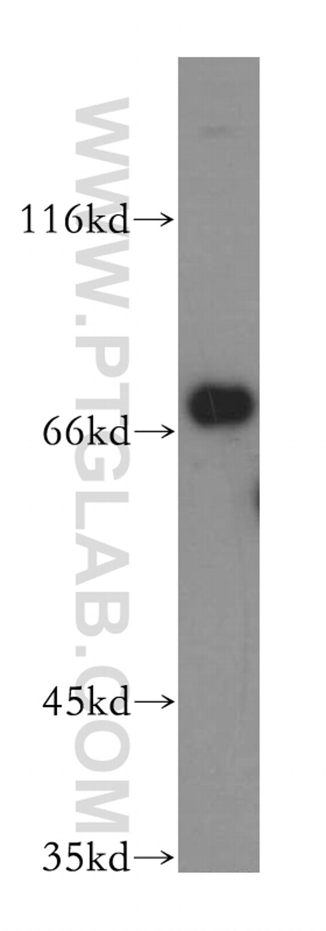 GPD2 Antibody in Western Blot (WB)