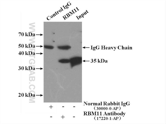 RBM11 Antibody in Immunoprecipitation (IP)