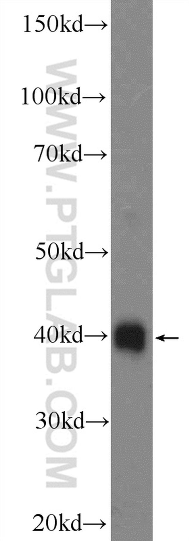 RBM11 Antibody in Western Blot (WB)