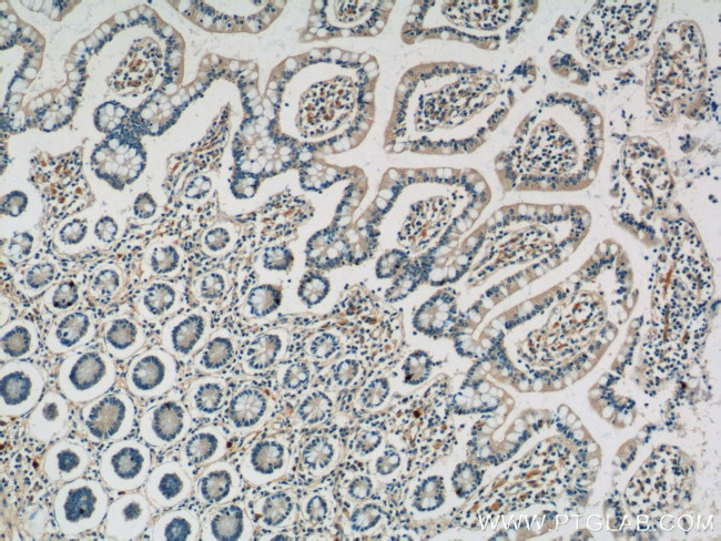 TLR7 Antibody in Immunohistochemistry (Paraffin) (IHC (P))