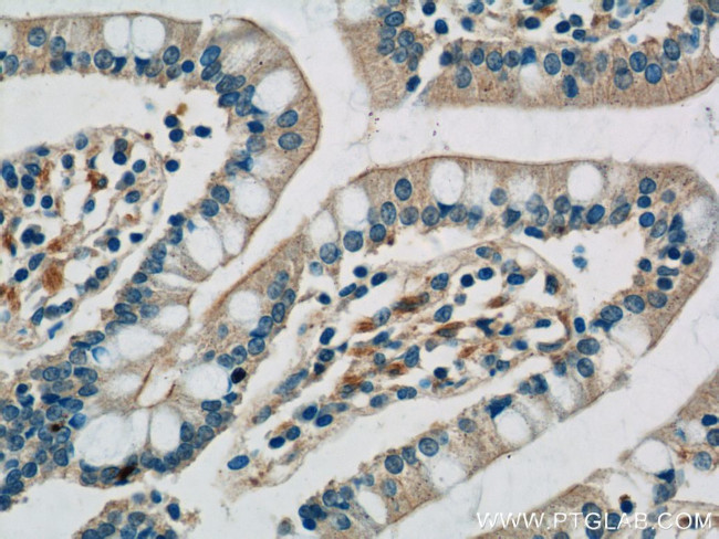 TLR7 Antibody in Immunohistochemistry (Paraffin) (IHC (P))