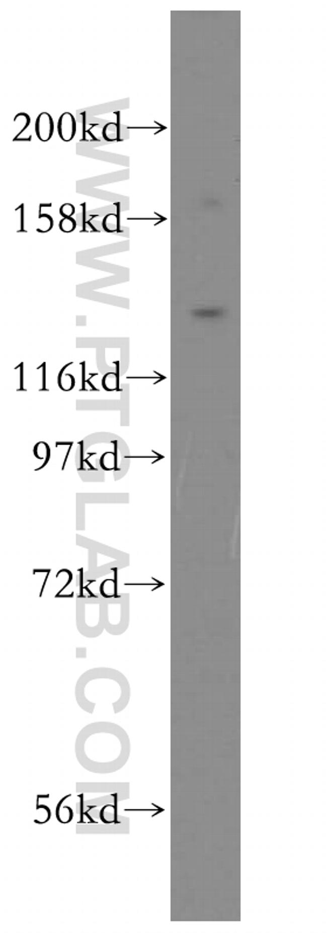 TLR7 Antibody in Western Blot (WB)