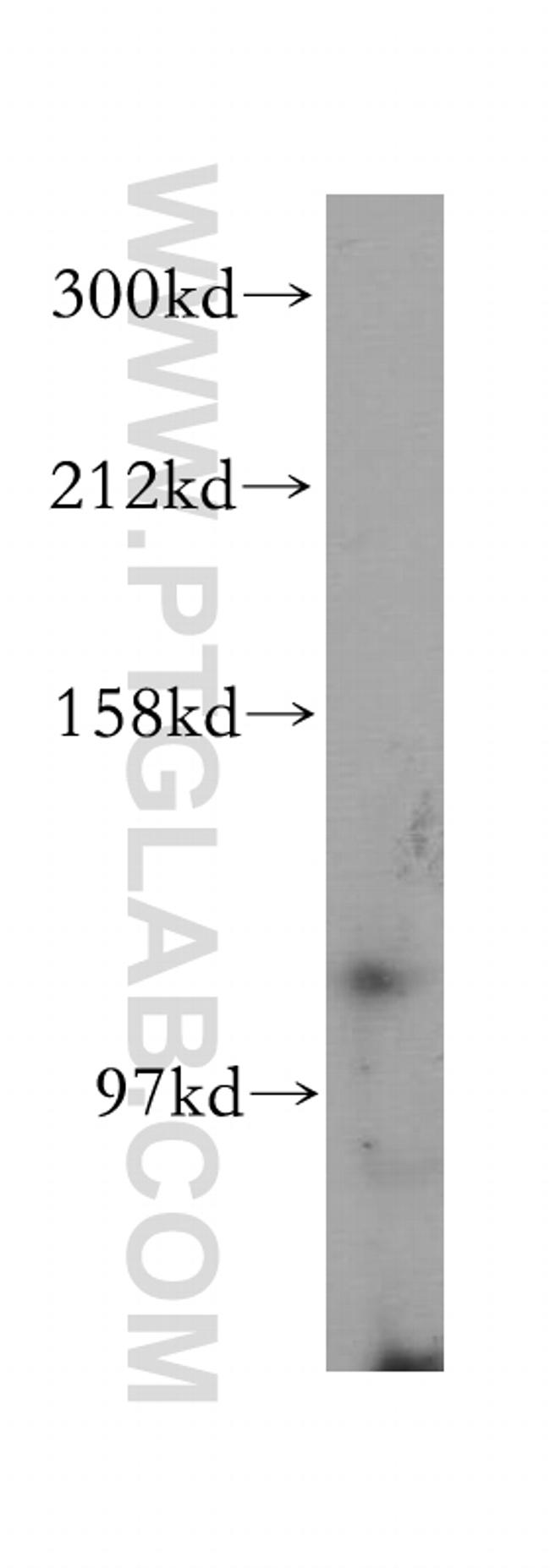 TLR7 Antibody in Western Blot (WB)