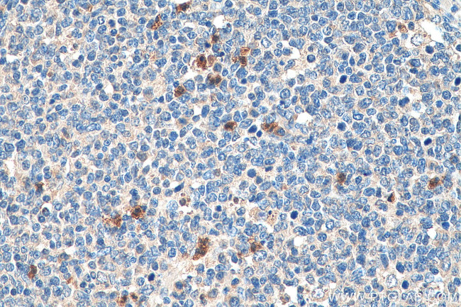 TLR2 Antibody in Immunohistochemistry (Paraffin) (IHC (P))