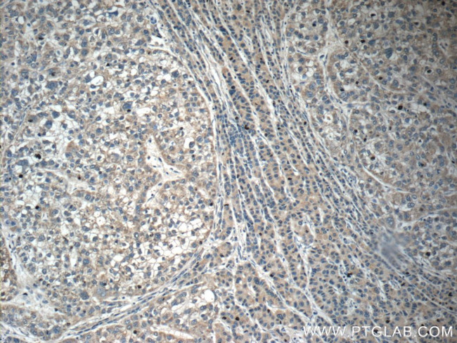 C6 Antibody in Immunohistochemistry (Paraffin) (IHC (P))