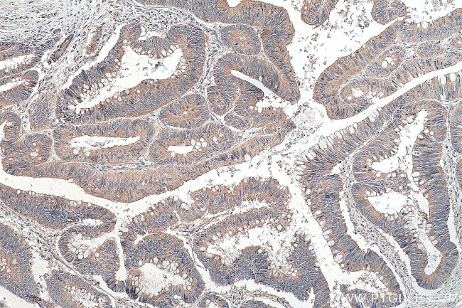 NSUN6 Antibody in Immunohistochemistry (Paraffin) (IHC (P))