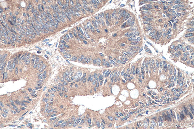 NSUN6 Antibody in Immunohistochemistry (Paraffin) (IHC (P))