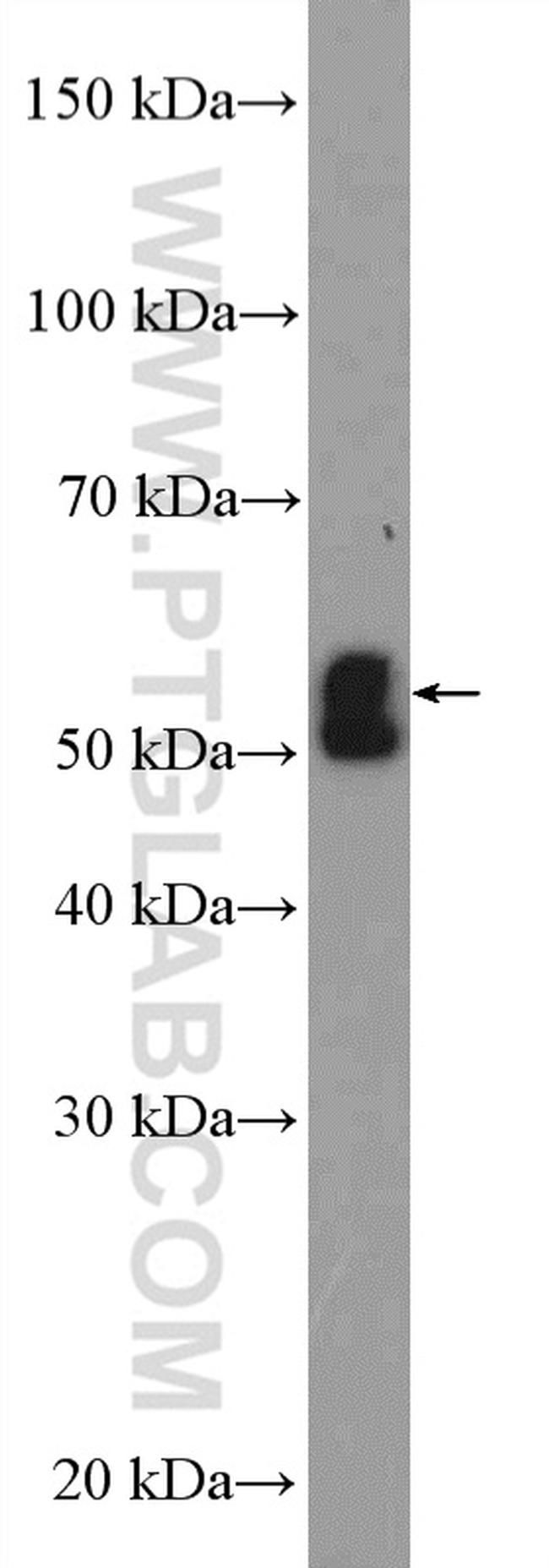 NSUN6 Antibody in Western Blot (WB)