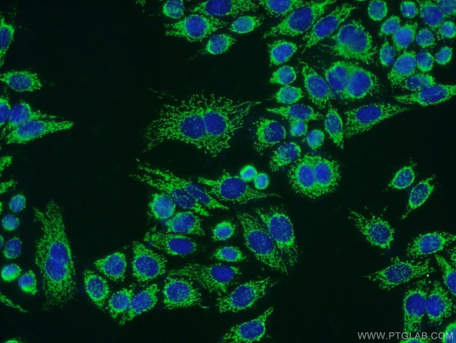 ATPB Antibody in Immunocytochemistry (ICC/IF)