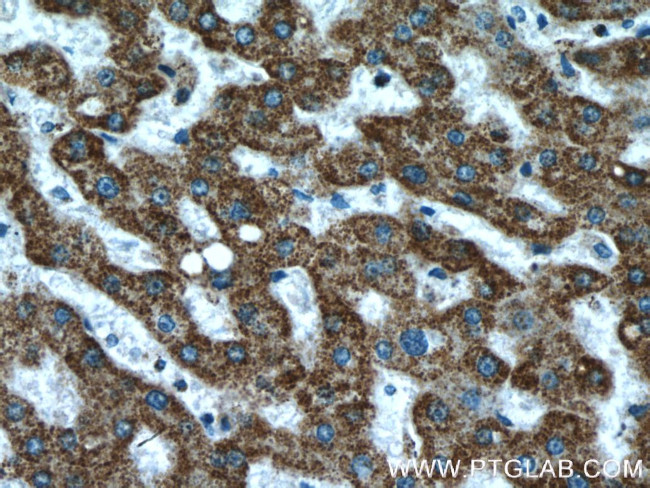 ATPB Antibody in Immunohistochemistry (Paraffin) (IHC (P))