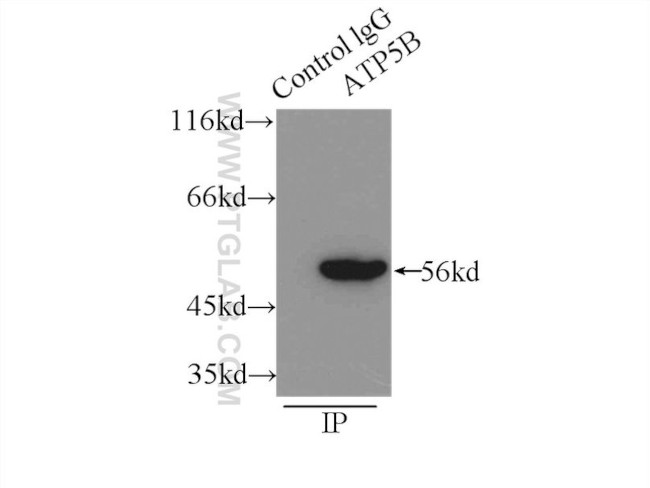 ATPB Antibody in Immunoprecipitation (IP)