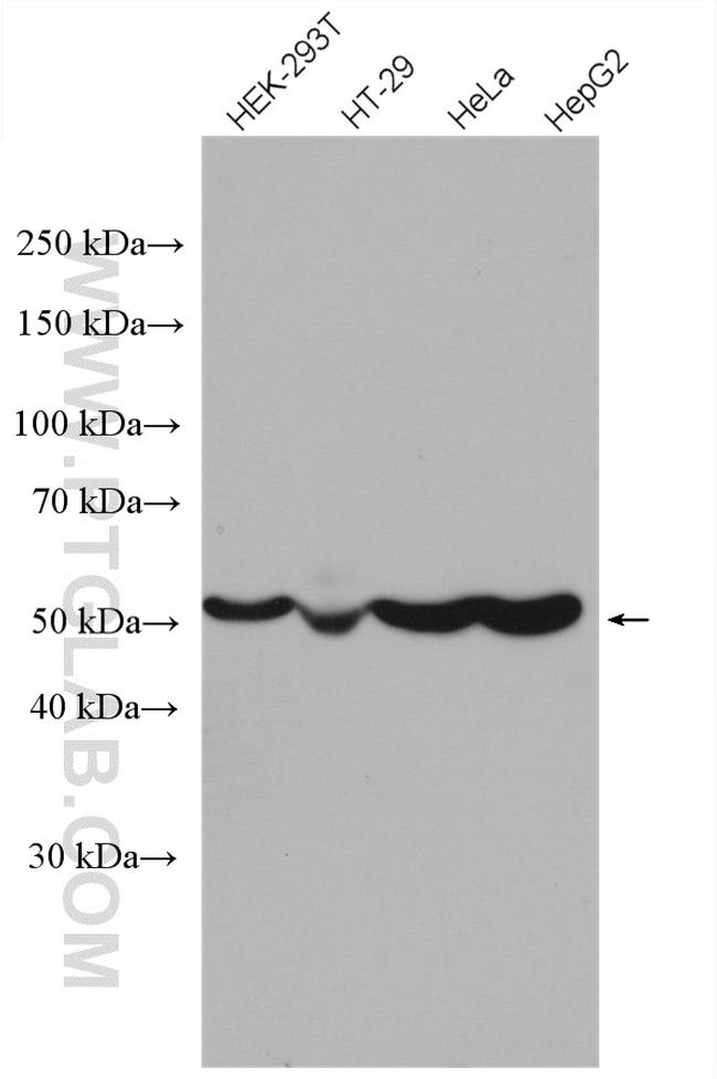 ATPB Antibody in Western Blot (WB)