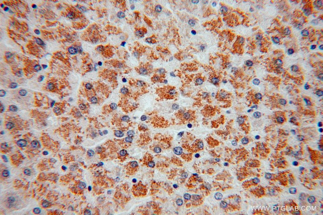 ATPB Antibody in Immunohistochemistry (Paraffin) (IHC (P))