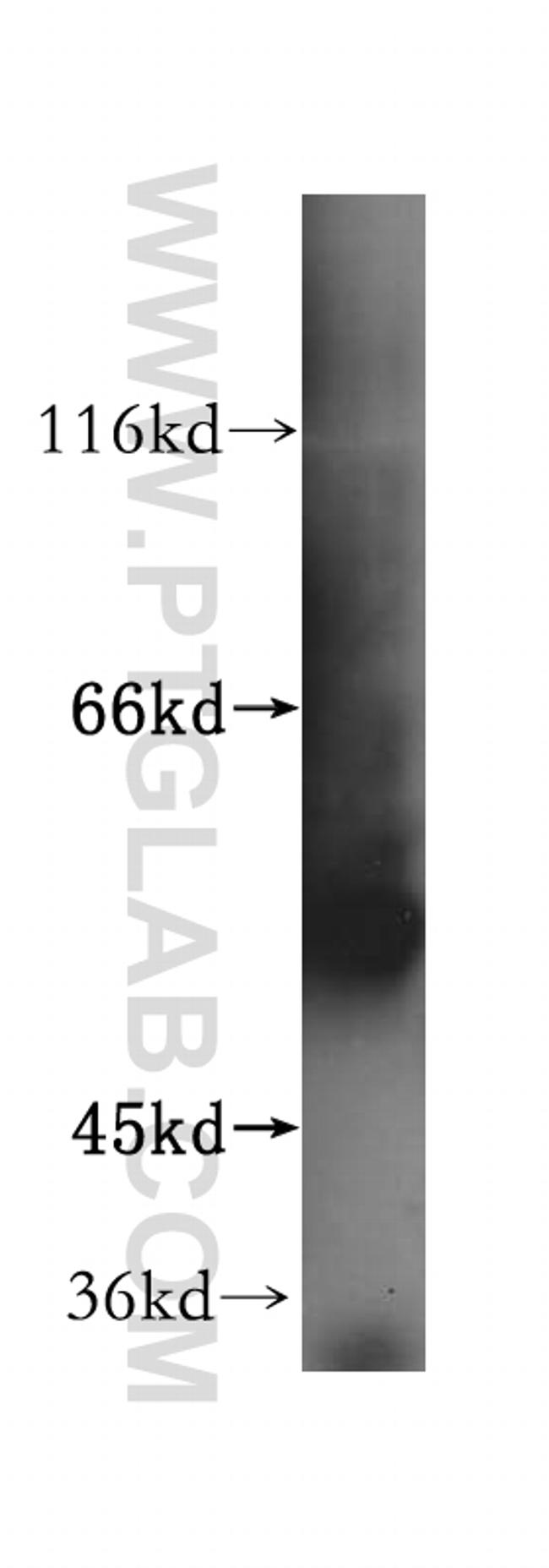 ATPB Antibody in Western Blot (WB)