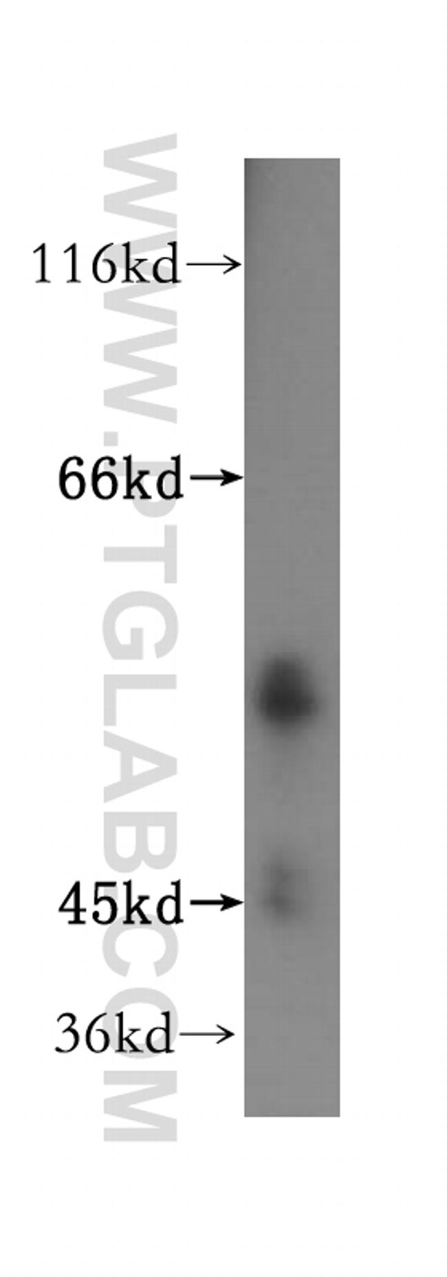 ATPB Antibody in Western Blot (WB)