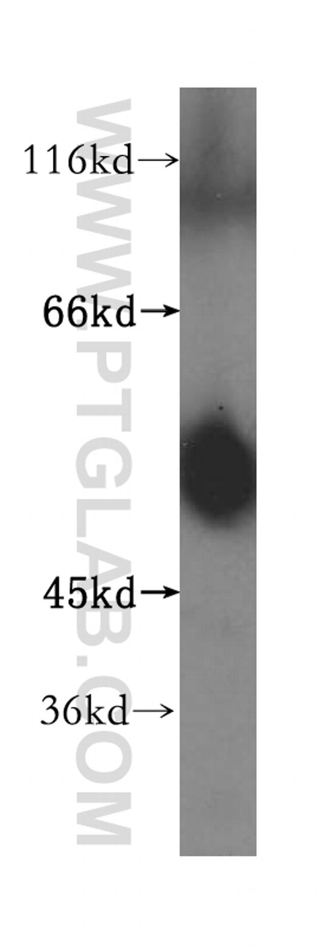 ATPB Antibody in Western Blot (WB)