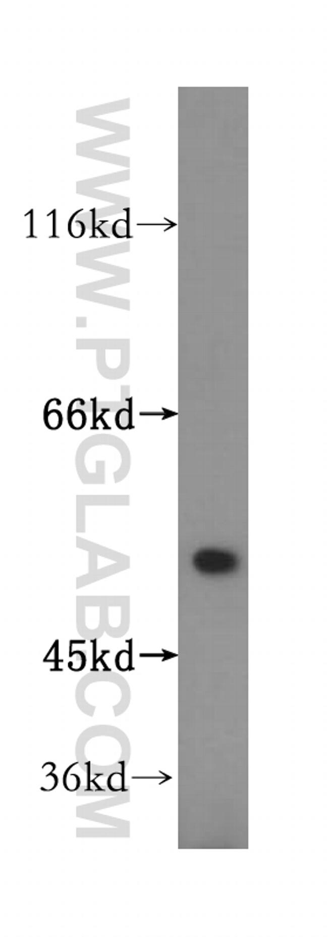 ATPB Antibody in Western Blot (WB)