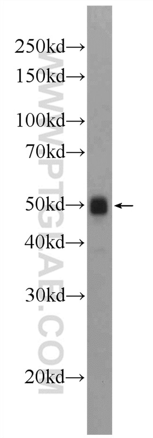 ATPB Antibody in Western Blot (WB)