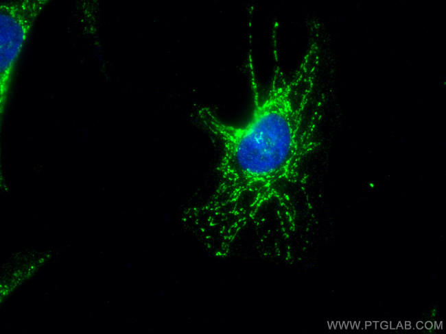 ATPB Antibody in Immunocytochemistry (ICC/IF)