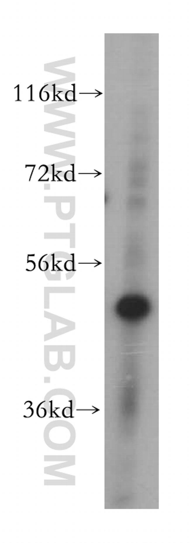 PUS3 Antibody in Western Blot (WB)